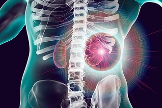 Как новые технологии предсказывают риск острой почечной недостаточности