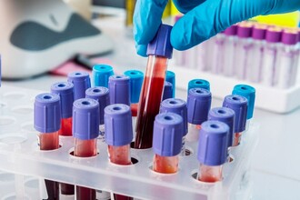 Белок p38γ: как испанские ученые нашли новую мишень для лечения рака печени