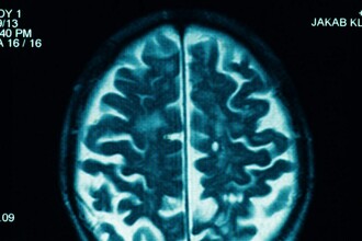 Как мозг превращает буквы в смысл: нейроны чтения на карте мозга