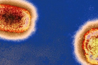 Оспа обезьян мутирует: почему вирус изменился сильнее, чем ожидали учёные