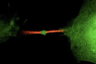 Отходы или послание? Как РНК в среднем теле клетки влияет на рак