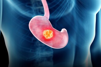 От воспаления к раку: как микроРНК разрушает защиту желудка