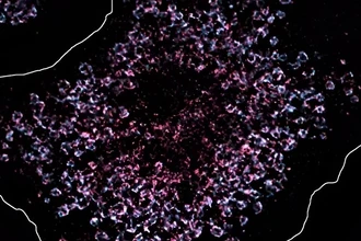 Как сломанный рецептор TLR7 провоцирует волчанку и можно ли его остановить