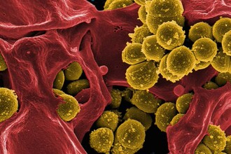 Ученые нашли способ обезвредить золотистый стафилококк