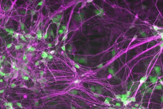 Новые мишени для лечения БАС: гены SYF2 и белок PIKFYVE