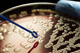 Как предсказать устойчивость туберкулёза? Генетическое древо болезни даёт ответ