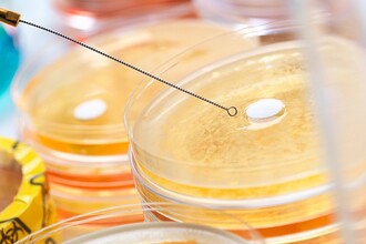 Бактериальная угроза: как микробы обмениваются устойчивостью к антибиотикам