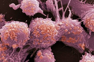 Ген APOE4: почему он замедляет рак, но опасен для мозга?