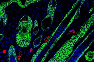 Новый гидрогель против шрамов: как заставить кожу заживать без рубцов
