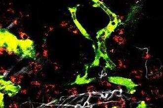 Можно ли научить врождённый иммунитет целенаправленно атаковать раковые клетки?