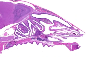 Секрет эффективной вакцины в нос: как работают назальные спреи