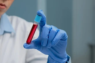 Хирург Ашот Григорьян: как предотвратить тромбоз и защитить сосуды