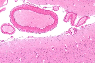 Как мозг слепых от рождения создаёт уникальные нейронные связи
