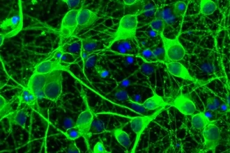 Почему бессонница разрушает память: как сон превращает воспоминания в опыт