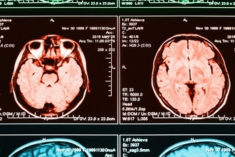 Учёные выяснили, почему в мозге рождается гнев и как две сети вызывают агрессию