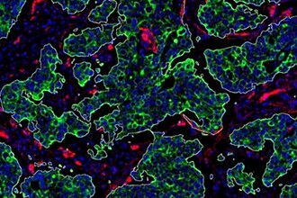 Тайные сигналы опухоли: как рак обманывает и захватывает здоровые клетки