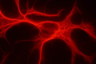 Рисперидон и заикание: как препарат воздействует на клетки мозга