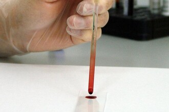 Умные часы как медицинский прибор: что данные с запястья говорят о здоровье