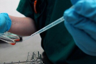 Тестостерон и болезни: разный риск для мужчин и женщин