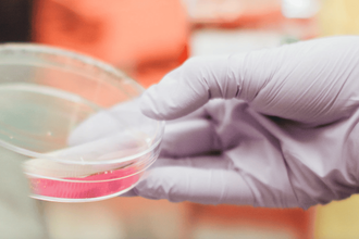 Молекула риска: почему высокий IL-6 увеличивает опасность рака при диабете