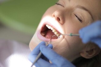 Здоровье десен и мозг: как болезни полости рта связаны с риском Альцгеймера