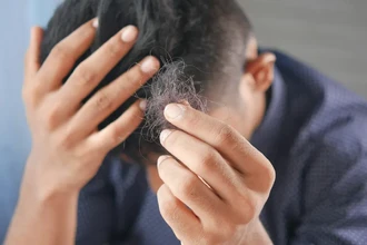 Натуральный сахар против облысения: новое открытие в борьбе за волосы