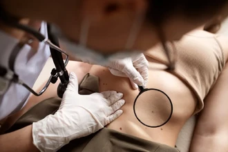 Новый ИИ-бот в Telegram анализирует родинки по фото и ищет клиники