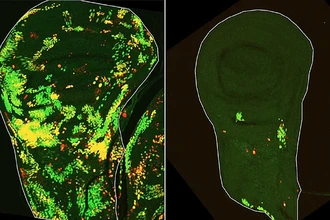 Ученые нашли общий механизм регенерации тканей и выживания раковых клеток