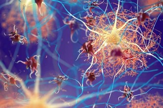 Где прячется ВИЧ: открыт ключевой резервуар в клетках мозга