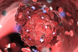 Новый способ лечения тромбов: наночастицы против сверхактивных нейтрофилов