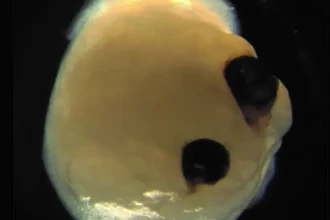 Прорыв в нейробиологии: ткань мозга успешно разморозили после 18 месяцев