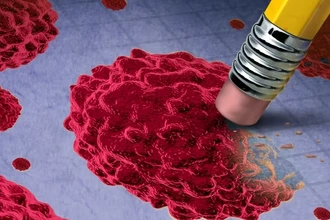 Рак молочной железы: комбинированная терапия почти вдвое повышает ремиссию