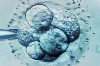 Ученые нашли ген боли: как редактирование ДНК поможет при хронических страданиях