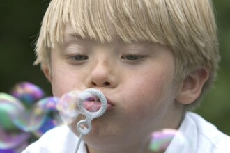 Синдром Дауна: ученые нашли способ восстановить память и когнитивные функции