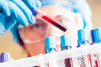 Новый препарат NMS-01940153E против рака печени: первые результаты