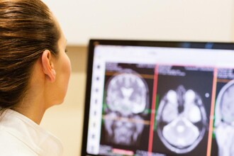 Гидрогель STH: саморассасывающаяся заглушка для сосудов при аневризме