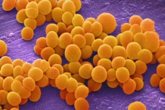 Экспресс-тест за 2 часа: как определяют чувствительность бактерий к антибиотикам