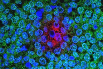 Ученые превращают метастазирующие раковые клетки в безвредный жир