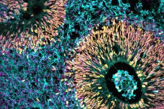 Как стресс в начале беременности влияет на мозг ребенка и другие новости нейронаук