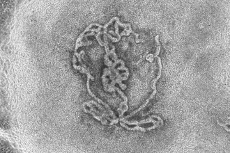 Лабораторные яички: как искусственные органы помогут в лечении бесплодия