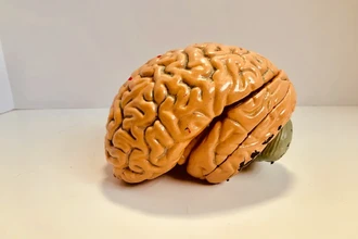 Болезнь Альцгеймера: найдены редкие случаи передачи между людьми