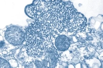 Вирус Нипах: почему несколько случаев вызывают большую тревогу ученых