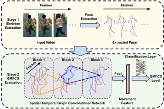 Умный анализ движений: как видео помогает диагностировать неврологические нарушения у детей