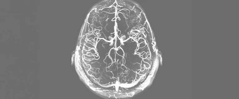 5ed440da-e292-45eb-9ea2-078fdaae398e